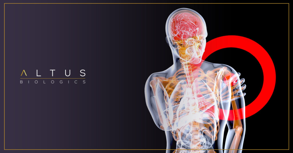 Understanding Flares: What They Are, Why They Happen, and How Biologics Help