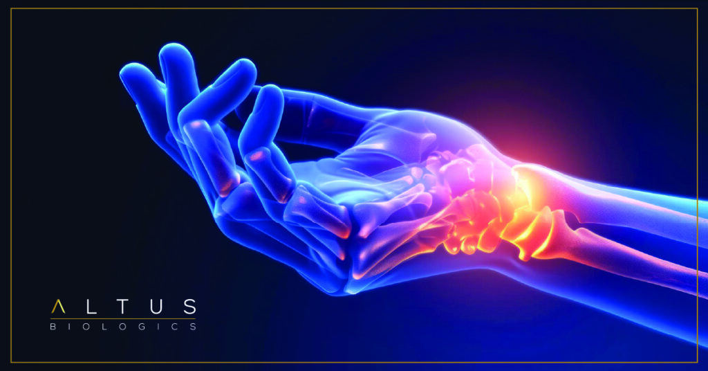 Rheumatology Spotlight: Improving Continuity of Care with In-Office Biologic Infusion Programs