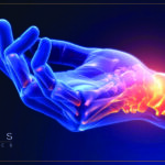 Rheumatology Spotlight: Improving Continuity of Care with In-Office Biologic Infusion Programs